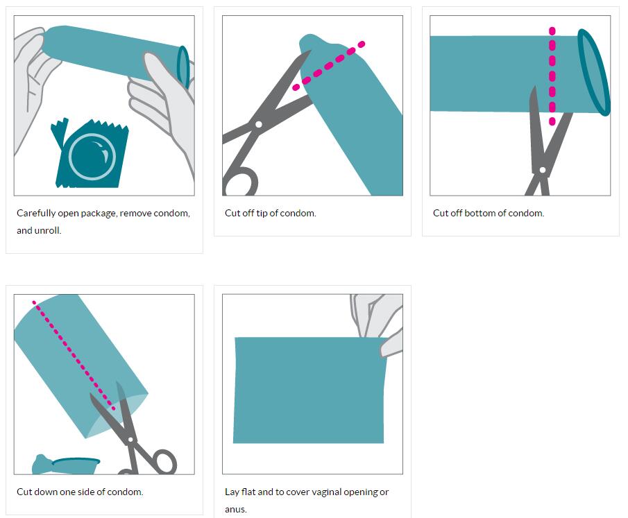 How To Make a Dental Dam From a Condom?